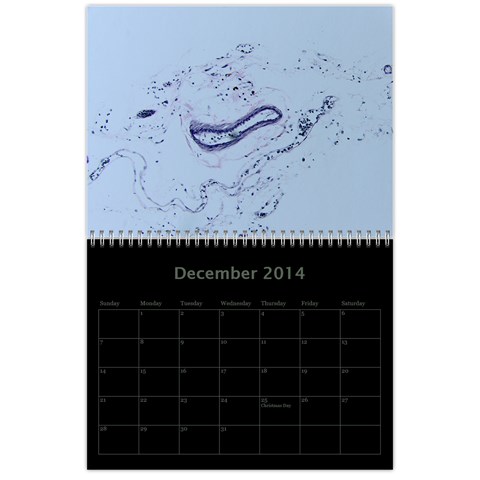 Dug 2014 By Nikki Johnson Dec 2014