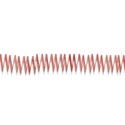 Stitches5
